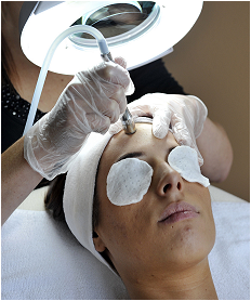 Mircroderm Treatment